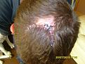 Click image for larger version

Name:	injury 006.jpg
Views:	195
Size:	88.0 KB
ID:	1524803